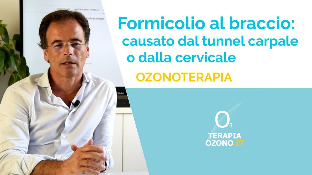 ozonoterapia per curare formicolio al braccio da tunnel carpale o cervicale