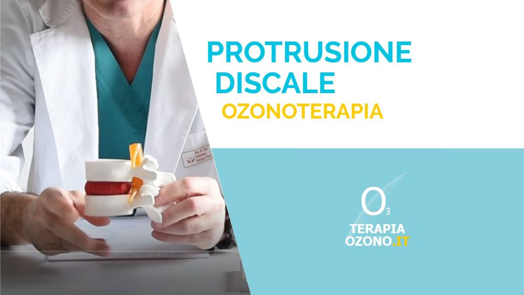 ozonoterapia per curare le protusioni discali. Prenota seduta nella clinica di Milano