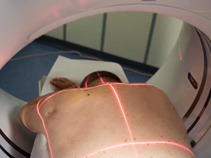 ozonoterapia paravertebrale per ernia al disco a Milano
