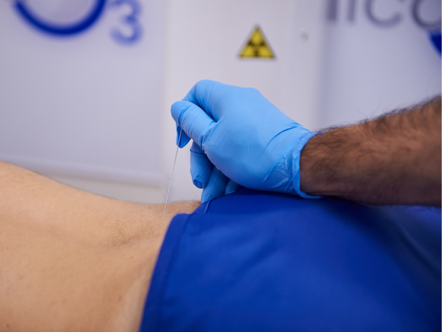 Seduta di ozonoterapia guidata tramite RX per il trattamento della cruralgia.