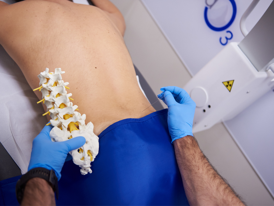 Medico esegue ozonoterapia RX guidata per trattare la lombalgia cronica.