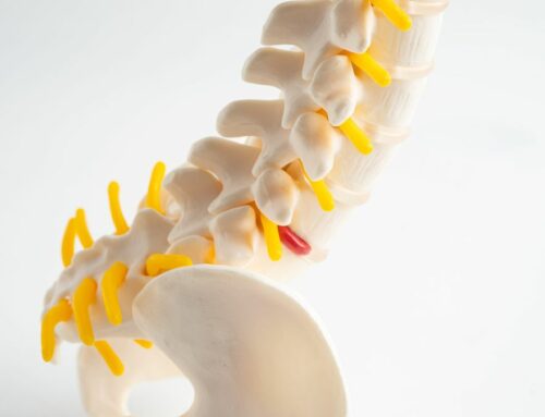 L’ozono per il trattamento delle problematiche discali lombari: le evidenze della letteratura