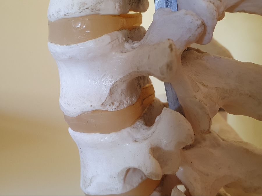 Schema anatomico della colonna vertebrale con forami intervertebrali e radici nervose